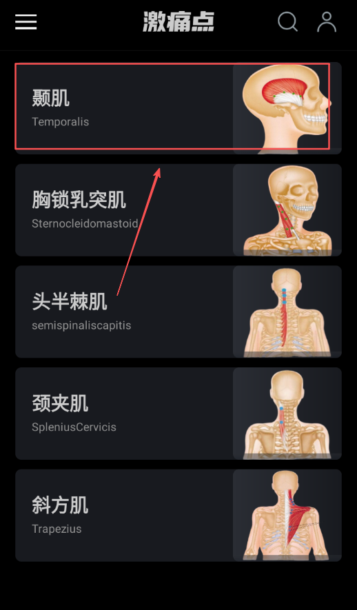肌肉激痛点图谱