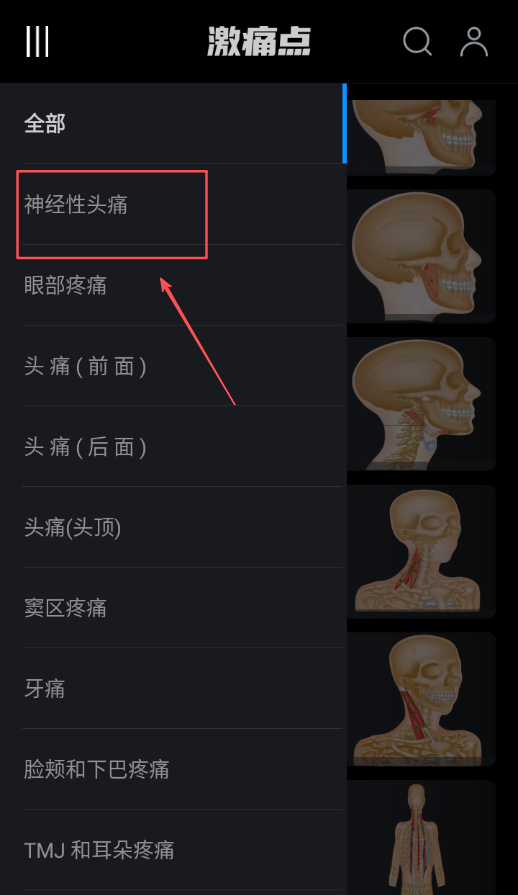 肌肉激痛点图谱