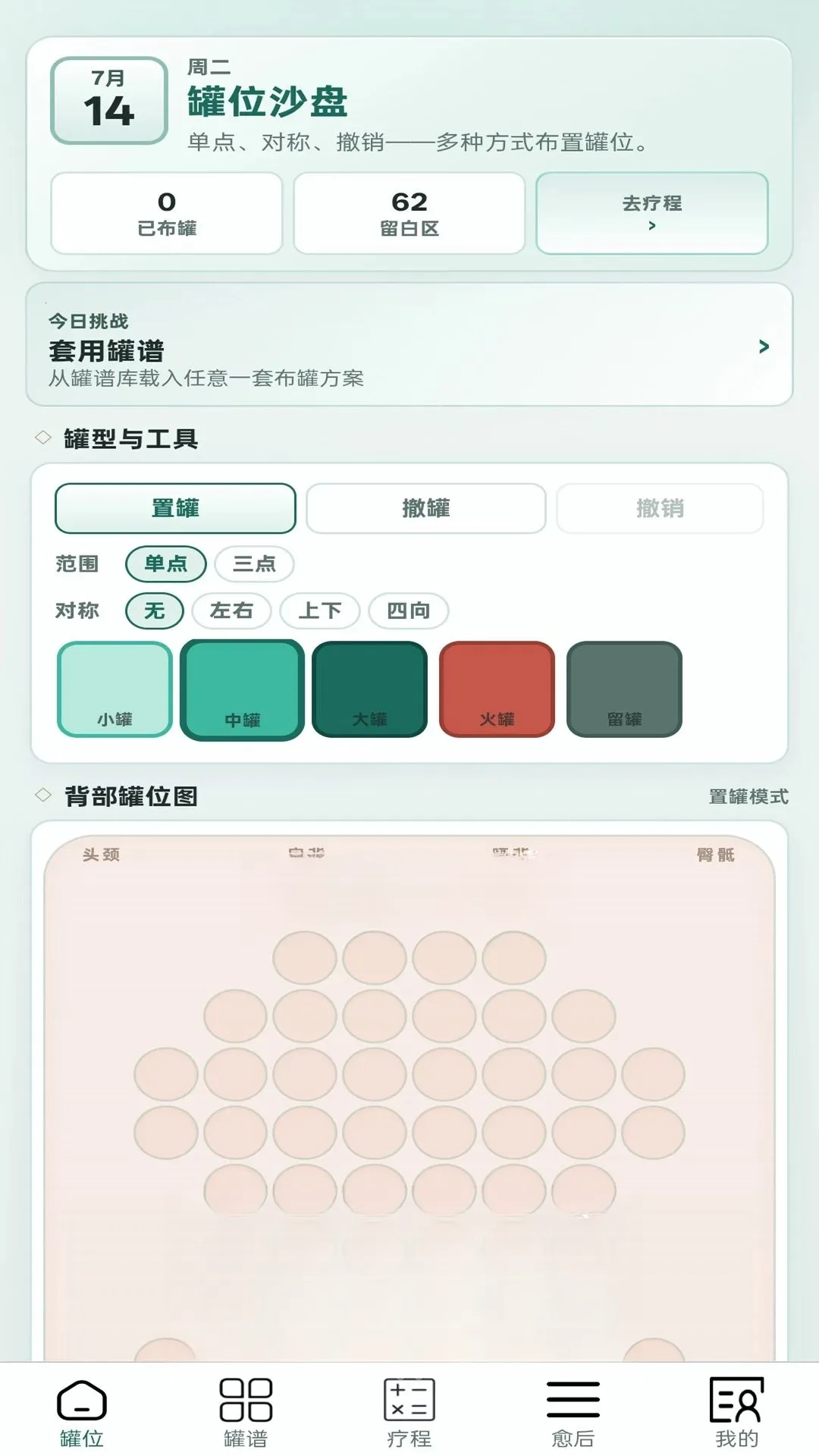 火罐多多2026最新版本v1.0.1(1)